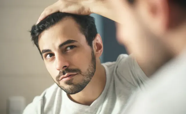 Top Hair Transplant Alternatives for Men