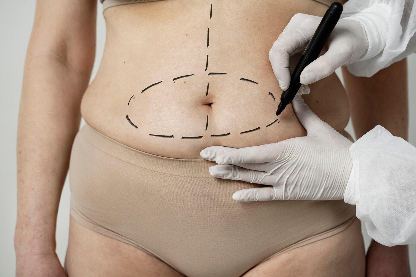 Affordable U-Lipo Mira Road clinic & borivali