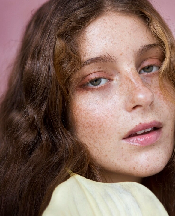 Freckles Treatment Mira Road & Borivali