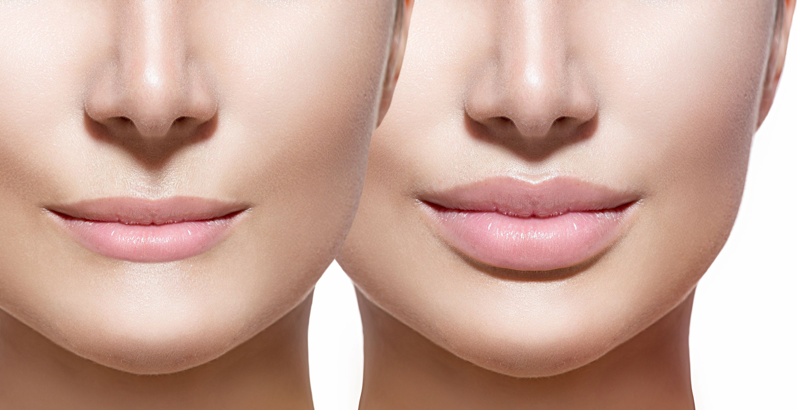 Best Lip Augmentation Clinic Mira Road & Borivali  
