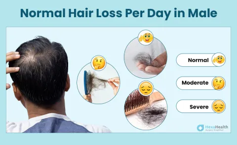 Hair Fall in Males: Top Causes & What You Can Do About It