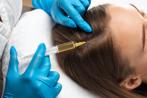 Best hair prp treatment in mira road & borivali
