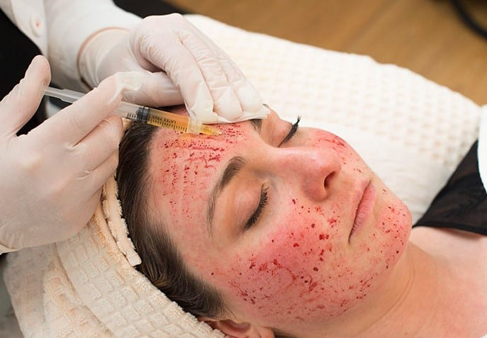 Expert Vampire Facial Borivali, Mira road Nine Eleven Clinic 